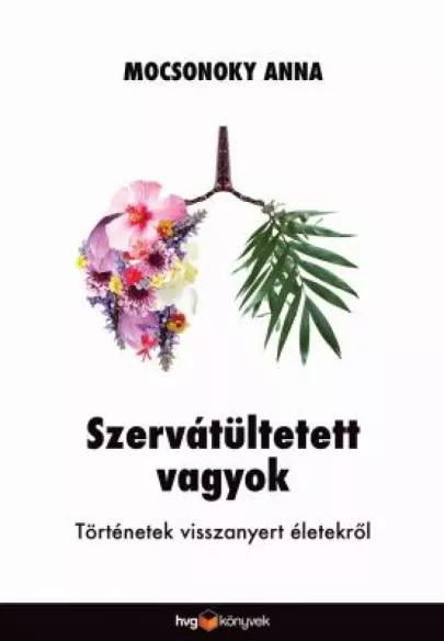 Szervátültetett vagyok (e-könyv)